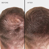 Fibre épaississante pour cheveux Nanogen Marron clair 15g