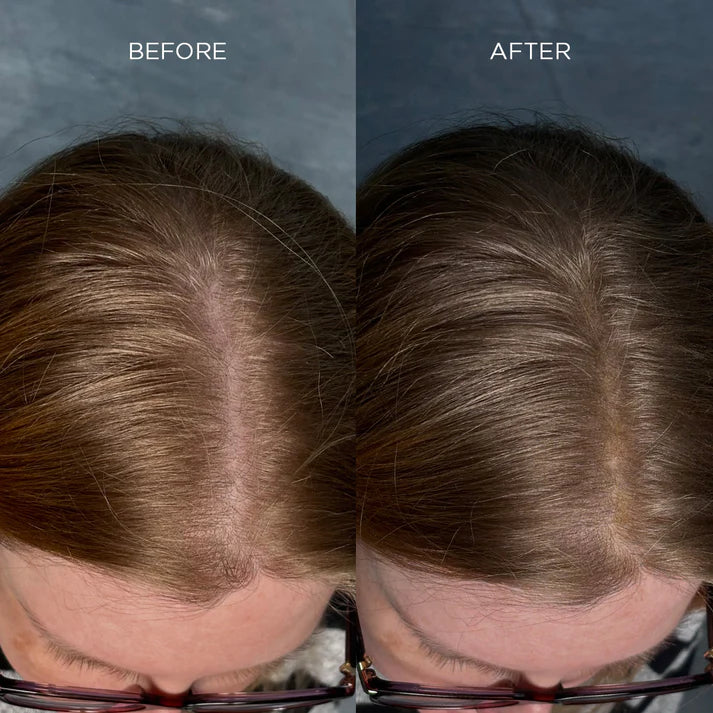 Fibres épaississantes pour cheveux Nanogen blanches