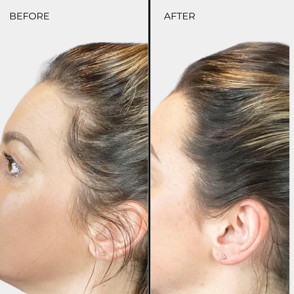 Fibres épaississantes pour cheveux Nanogen Blond foncé