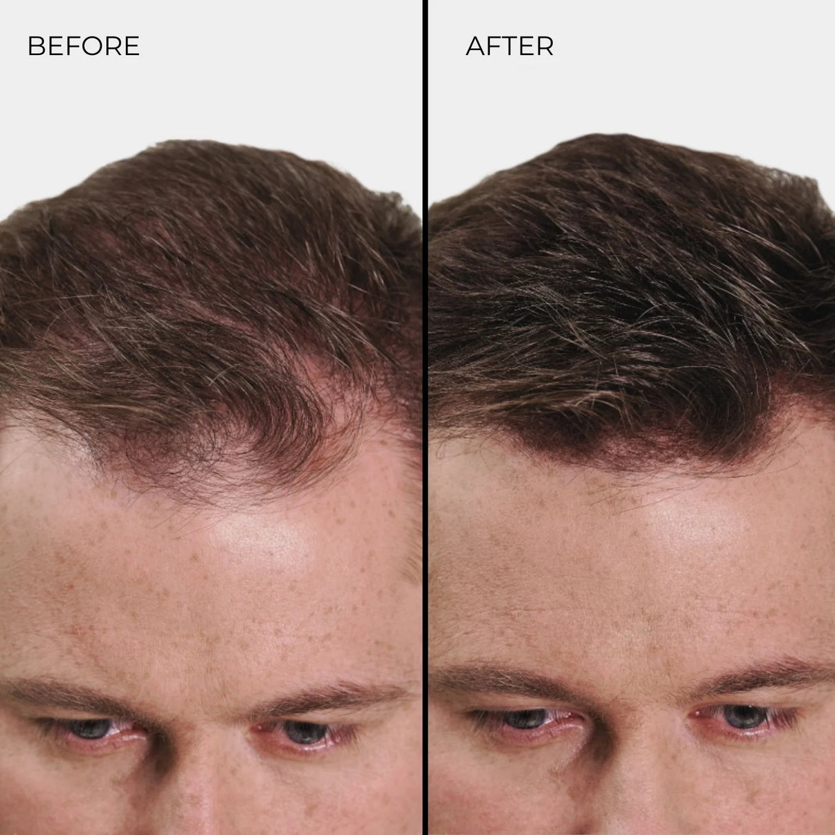 Fibres épaississantes pour cheveux Nanogen Blond clair